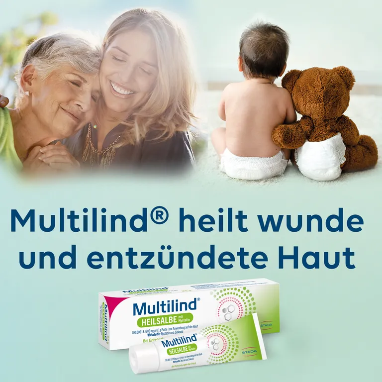 shopapotheke Multilind® Heilsalbe bei wunder und entzündeter Haut mit Zinkoxid und Nystatin - Jetzt 20% mit dem Code stada20 sparen* Letzte 3 Tage