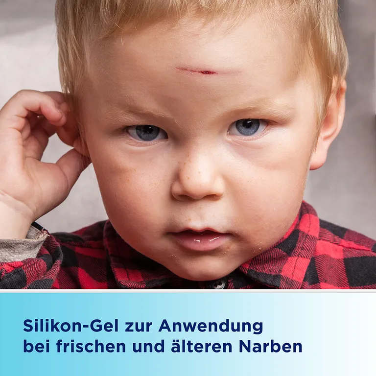 shopapotheke Bepanthen® Narben-Gel mit Massage-Roller Sonderangebot der Fabrik
