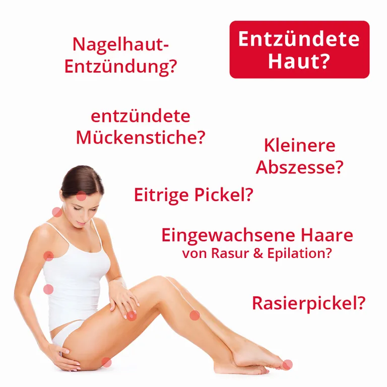shopapotheke ilon® Salbe classic bei Entzündungen der Haut Nur noch ein Tag übrig