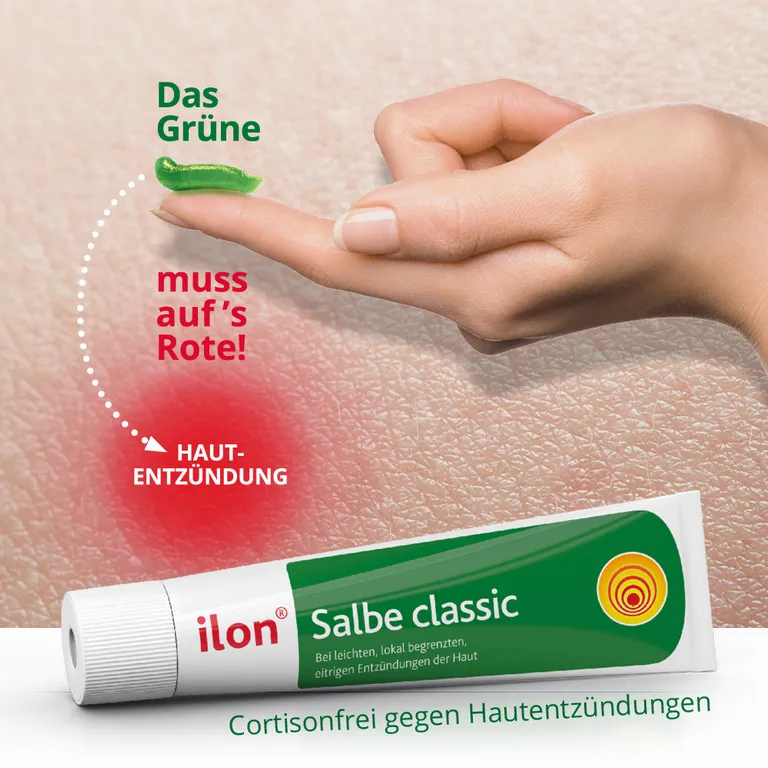 shopapotheke ilon® Salbe classic bei Entzündungen der Haut Nur noch ein Tag übrig