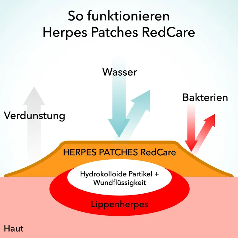 shopapotheke Redcare Herpes Patches Vatertagsangebot