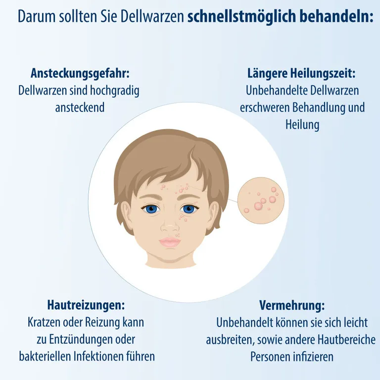 shopapotheke Evolsin® Dellwarzen Mittel I Für Erwachsene & Kinder ab 2 Jahren I Dellwarzen Behandlung mit Ätzkali Online